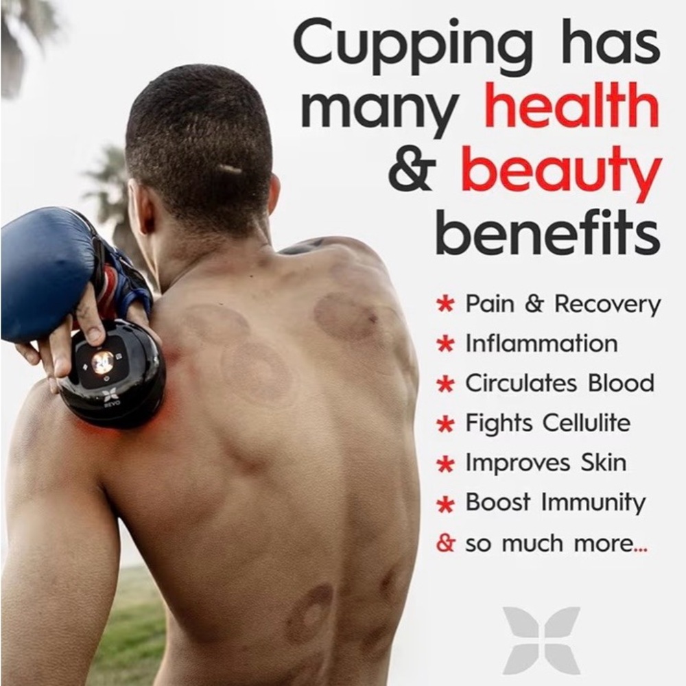 REVO 4-in-1 Smart Cupping Massager – Built for Athlete Recovery